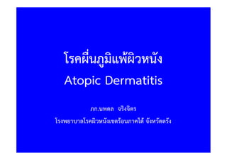 โรคผื่นภูมิแพผิวหนัง
Atopic Dermatitis
ภก.นพดล จริงจิตร
โรงพยาบาลโรคผิวหนังเขตรอนภาคใต จังหวัดตรัง
 