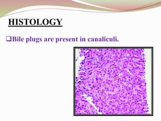 HISTOLOGY
Bile plugs are present in canaliculi.
 