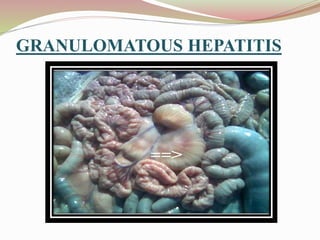 GRANULOMATOUS HEPATITIS
 