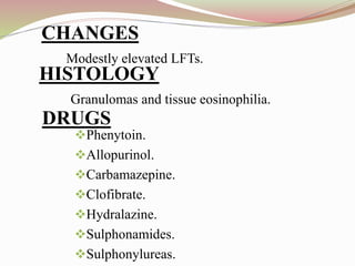 CHANGES
Modestly elevated LFTs.
Phenytoin.
Allopurinol.
Carbamazepine.
Clofibrate.
Hydralazine.
Sulphonamides.
Sulphonylureas.
HISTOLOGY
Granulomas and tissue eosinophilia.
DRUGS
 