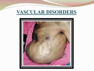 VASCULAR DISORDERS
 