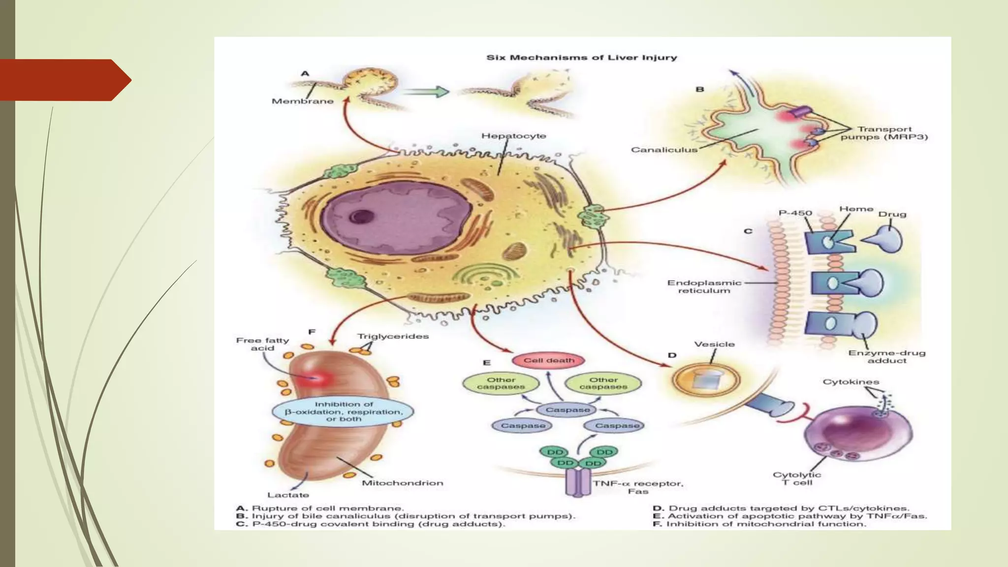 Drug induced liver injury (DILI) | PPTX