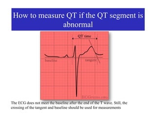 How to measure QT if the QT segment is
               abnormal




The ECG does not meet the baseline after the end of the T wave. Still, the
crossing of the tangent and baseline should be used for measurements
 