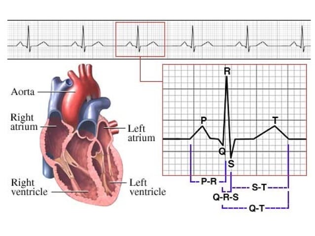 neurontin qt prolongation