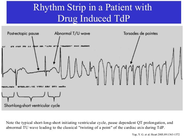 gabapentin and qt prolongation