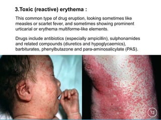Drug Induced Skin Disorders | PPTX