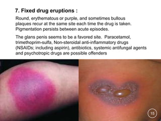 Fixed Drug Rash Drug Induced Skin Disorders | PPTX
