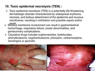 Drug Induced Skin Disorders PPTX drug-induced-skin-disorders-pptx