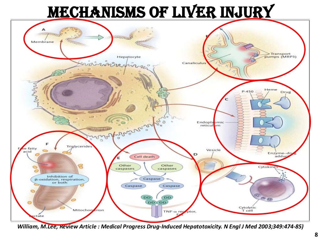 Drug induce liver disease mita