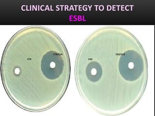 CLINICAL STRATEGY TO DETECT
            ESBL


       CTX/CLA         CAZ/CLA
 CTX             CAZ
 