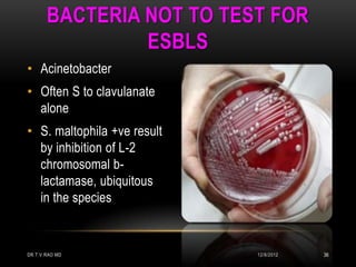 BACTERIA NOT TO TEST FOR
                ESBLS
• Acinetobacter
• Often S to clavulanate
  alone
• S. maltophila +ve result
  by inhibition of L-2
  chromosomal b-
  lactamase, ubiquitous
  in the species


DR.T.V.RAO MD                12/8/2012   36
 