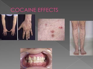 COCAINE EFFECTS