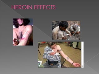 HEROIN EFFECTS