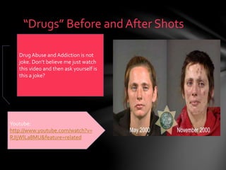 “Drugs” Before and After Shots
Drug Abuse and Addiction is not
joke. Don’t believe me just watch
this video and then ask yourself is
this a joke?
Youtube:
http://www.youtube.com/watch?v=
RJIjWlLa8MU&feature=related
 