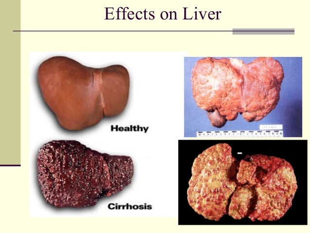 Substance Created By Mold That Damages The Liver Drugs abuse pschology 101