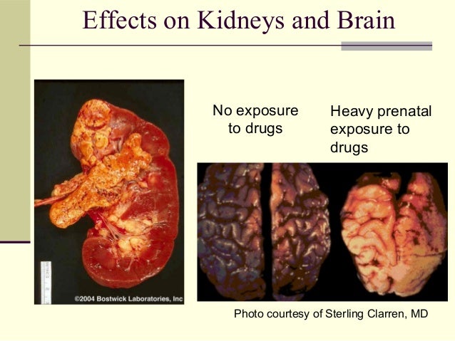 Drugs abuse pschology 101