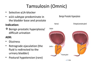 Tamsulosin (Omnic)
• Selective α1A-blocker
• α1A subtype predominate in
the bladder base and prostate
Indication:
 Benign prostatic hyperplasia/
difficult urination
ADR:
• Dizziness
• Retrograde ejaculation (the
fluid is redirected to the
urinary bladder)
• Postural hypotension (rare)
 