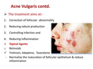 Acne Vulgaris contd.
 The treatment aims at:-
1. Correction of follicular abnormality
2. Reducing sebum production
3. Controlling infection and
4. Reducing Inflammation
 Topical Agents
o Retinoids
 Tretinoin, Adaplene, Tazarotene
- Normalize the maturation of follicular epithelium & reduce
inflammation
 