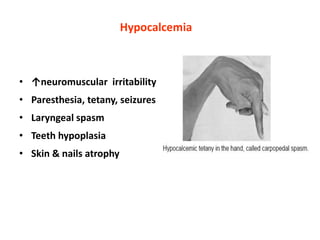 • ↑neuromuscular irritability
• Paresthesia, tetany, seizures
• Laryngeal spasm
• Teeth hypoplasia
• Skin & nails atrophy
Hypocalcemia
 