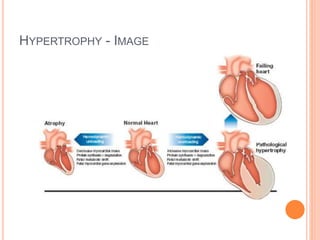 HYPERTROPHY - IMAGE
 