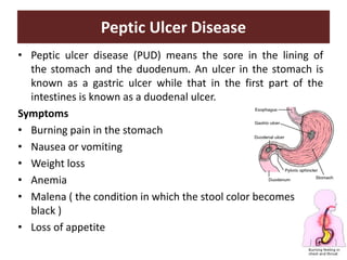 Peptic Ulcer Disease
• Peptic ulcer disease (PUD) means the sore in the lining of
the stomach and the duodenum. An ulcer in the stomach is
known as a gastric ulcer while that in the first part of the
intestines is known as a duodenal ulcer.
Symptoms
• Burning pain in the stomach
• Nausea or vomiting
• Weight loss
• Anemia
• Malena ( the condition in which the stool color becomes
black )
• Loss of appetite
 