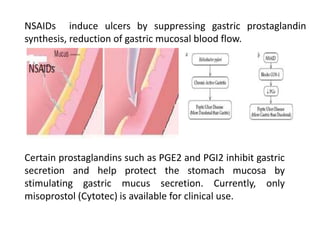 NSAIDs induce ulcers by suppressing gastric prostaglandin
synthesis, reduction of gastric mucosal blood flow.
Certain prostaglandins such as PGE2 and PGI2 inhibit gastric
secretion and help protect the stomach mucosa by
stimulating gastric mucus secretion. Currently, only
misoprostol (Cytotec) is available for clinical use.
 