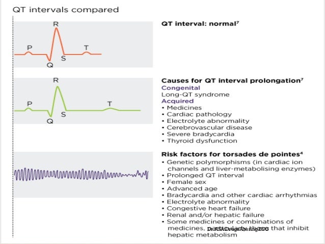 ekg changes with adderall