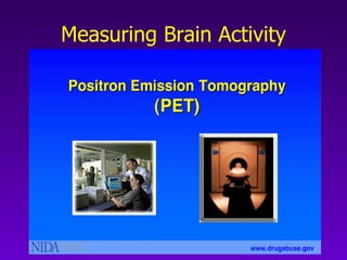 Measuring Brain Activity 