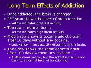 Long Term Effects of Addiction Once addicted, the brain is changed.   PET scan shows the level of brain function Yellow indicates greatest activity Top row = normal brain.  Yellow indicates high brain activity Middle row shows a cocaine addict’s brain after 10 days without any cocaine. Less yellow = less activity occurring in the brain. Third row shows the same addict’s brain after 100 days without any cocaine.  A little more yellow, but the addict’s brain is not back to a normal level of functioning  