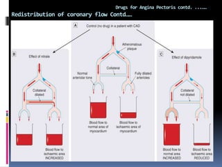 Redistribution of coronary flow Contd……
Drugs for Angina Pectoris contd. ...……
 