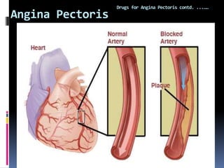 Drugs for Angina Pectoris contd. ...……
Angina Pectoris
 