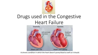 Drugs used in the Congestive
Heart Failure
A chronic condition in which the heart doesn't pump blood as well as it should.
 