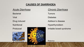 CAUSES OF DIARRHOEA
Acute Diarrhoea
Bacterial
Viral
Drug induced
Nutritional
Protozoal
Chronic Diarrhoea
Tumors
Diabetes
Addison’s disease
Hyperthyroidism
Irritable bowel syndrome
E. Coli bacteria
Rotavirus
 