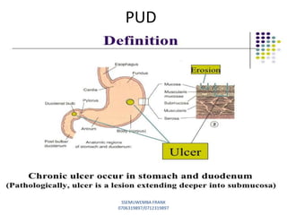 PUD
SSEMUWEMBA FRANK
0706319897/0712319897
 