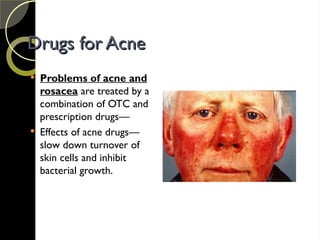 Drugs for Acne
Drugs for Acne
 Problems of acne and
rosacea are treated by a
combination of OTC and
prescription drugs—
 Effects of acne drugs—
slow down turnover of
skin cells and inhibit
bacterial growth.
 