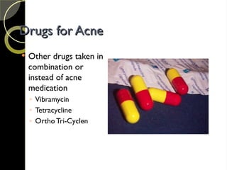 Drugs for Acne
Drugs for Acne
 Other drugs taken in
combination or
instead of acne
medication
◦ Vibramycin
◦ Tetracycline
◦ OrthoTri-Cyclen
 
