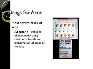 Drugs for Acne
Drugs for Acne
 Most severe cases of
acne
◦ Accutane—reduces
oil production; may
cause nosebleeds and
inflammation of areas of
the face
 