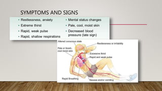 SYMPTOMS AND SIGNS
 