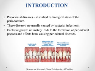 Drugs in periodontics | PPTX