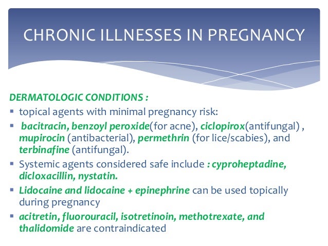 Is Hydroxyzine Considered A Benzodiazepine