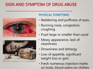 SIGN AND SYMPTOM OF DRUG ABUSE
PHYSICAL SYMPTOMS
• Reddening and puffiness of eyes,
• Running nose, congestion,
coughing.
• Pupil large or smaller than usual
• Messy appearance, lack of
cleanliness
• Drowsiness and lethargy
• Loss of appetite, significant
weight loss or gain
• Fresh numerous injection marks
on body, blood stains on clothes
 