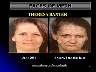 16
June 2001 3 years, 5 months later
THERESA BAXTER
www.yahoo.com/facesofmeth
FACES OF METH
 