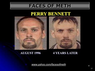17
AUGUST 1996 4 YEARS LATER
PERRY BENNETT
www.yahoo.com/facesofmeth
FACES OF METH
 