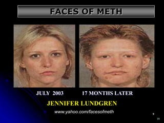 18
JENNIFER LUNDGREN
JULY 2003 17 MONTHS LATER
www.yahoo.com/facesofmeth
FACES OF METH
 