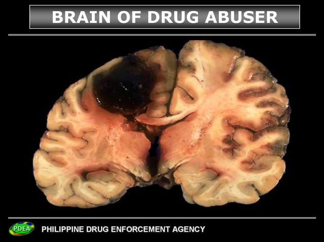drugs tagalog.ppt