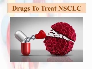 Drugs To Treat NSCLC
 