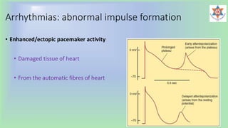 Arrhythmias: abnormal impulse formation
• Enhanced/ectopic pacemaker activity
• Damaged tissue of heart
• From the automatic fibres of heart
 