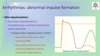 Arrhythmias: abnormal impulse formation
• After-depolarizations
• Secondary depolarizations
accompanying a normal or premature
action potential
• Delayed after-depolarization (DAD):
• Secondary deflection after
reaching RMP
• Generally results from Ca2+
overload (digitalis toxicity,
ischaemia-reperfusion).
 