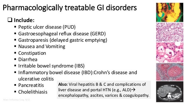 Gastroparesis bacterial overgrowth adhesions