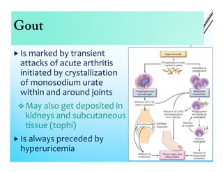 Gout
 Is marked by transient
attacks of acute arthritis
initiated by crystallization
of monosodium urate
within and around joints
 May also get deposited in
kidneys and subcutaneous
tissue (tophi)
 Is always preceded by
hyperuricemia
 